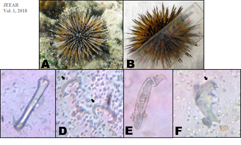 Figure 1. A. Echinometra methai, common sea urchin collected in Punta Dumalag, Matina Aplaya, Davao City. B. Measurement of specimen. C-F. Different spicules of the species: C. tylote, D. sigma, E. chela, F. isochela micro-graphs taken at 100X using bright field microscope (Amscope).